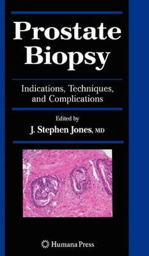 Cover image for Prostate Biopsy: Indications, Techniques, and Complications