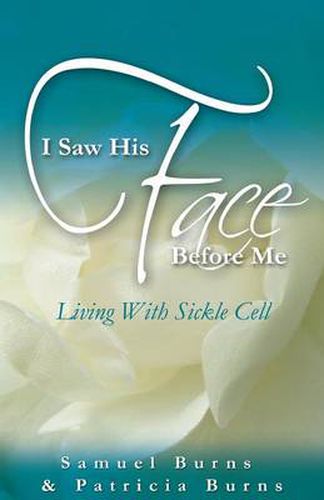 Cover image for I Saw His Face Before Me - Living with Sickle Cell Anemia