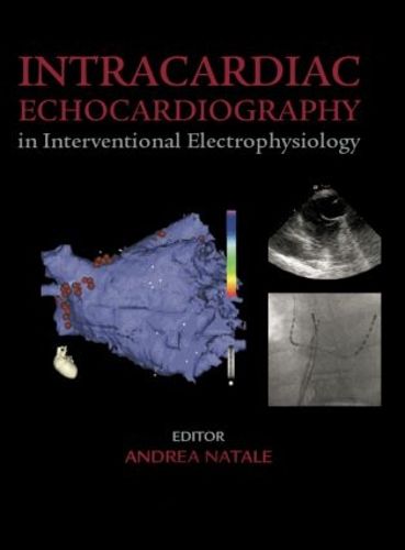 Cover image for Intracardiac Echocardiography in Interventional Electrophysiology: Advanced Management of Atrial Fibrillation and Ventricular Tachycardia