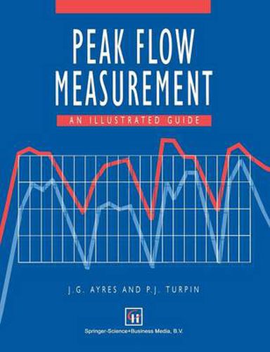 Cover image for Peak Flow Measurement: An illustrated guide