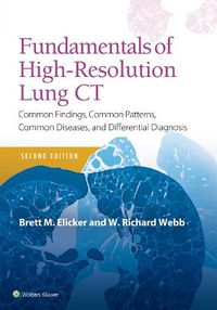 Cover image for Fundamentals of High-Resolution Lung CT: Common Findings, Common Patterns, Common Diseases and Differential Diagnosis