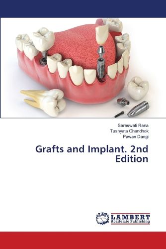 Cover image for Grafts and Implant. 2nd Edition