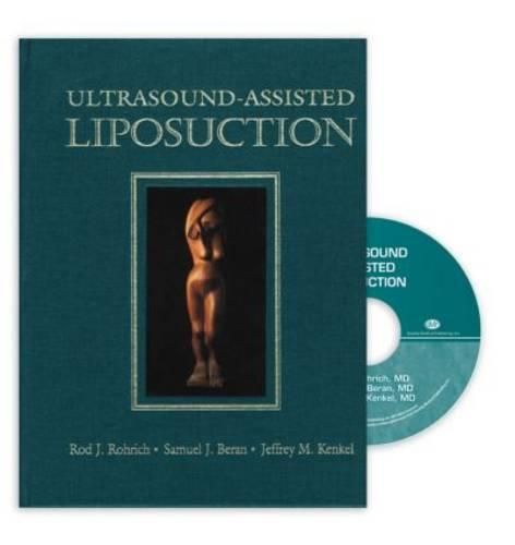 Cover image for Ultrasound-Assisted Liposuction