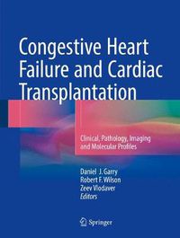 Cover image for Congestive Heart Failure and Cardiac Transplantation: Clinical, Pathology, Imaging and Molecular Profiles