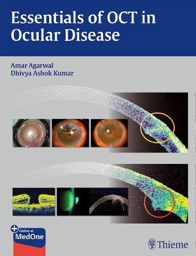 Cover image for Essentials of OCT in Ocular Disease