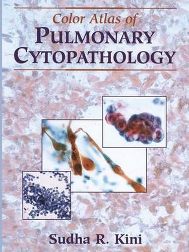 Cover image for Color Atlas of Pulmonary Cytopathology