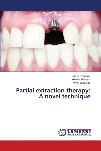 Cover image for Partial extraction therapy