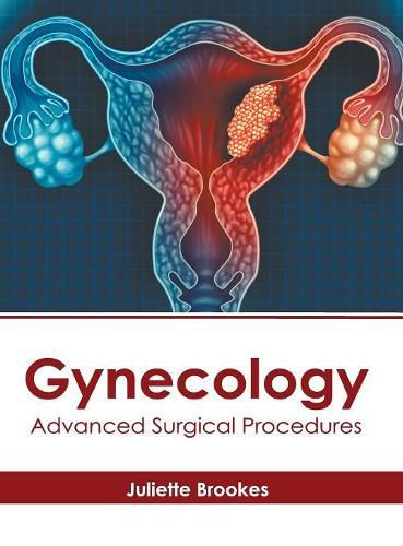 Cover image for Gynecology: Advanced Surgical Procedures