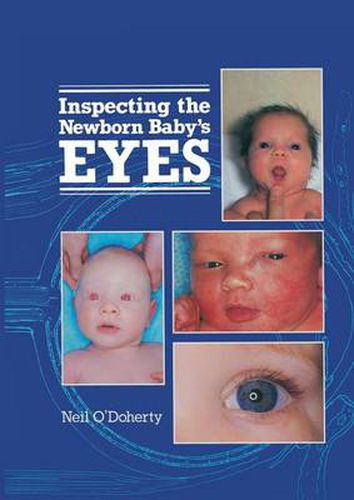 Cover image for Inspecting the Newborn Baby's Eyes