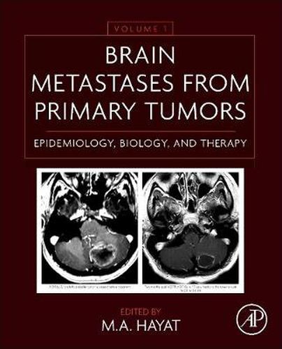 Cover image for Brain Metastases from Primary Tumors Volume 1: Epidemiology, Biology, and Therapy