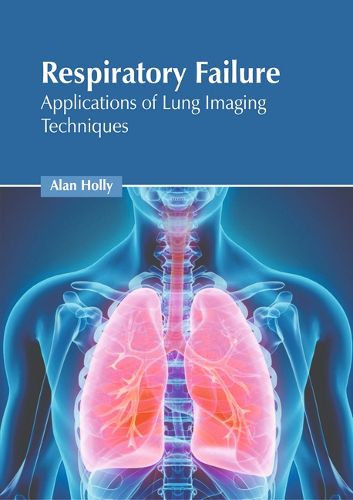 Cover image for Respiratory Failure: Applications of Lung Imaging Techniques