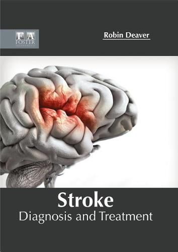 Cover image for Stroke: Diagnosis and Treatment