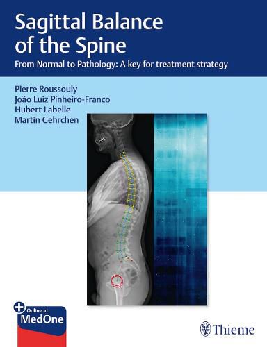 Sagittal Balance of the Spine: From Normal to Pathology: A Key for Treatment Strategy