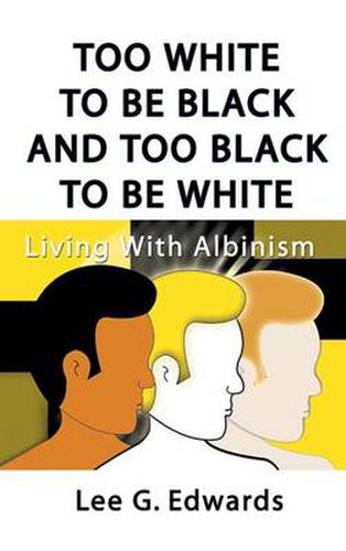 Cover image for Too White to be Black and Too Black to be White: Living with Albinism