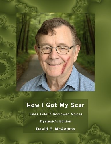 Cover image for How I Got My Scar