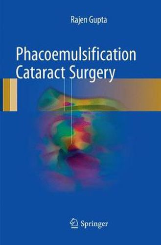 Cover image for Phacoemulsification Cataract Surgery