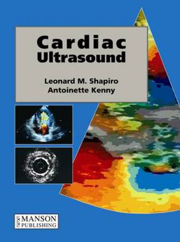 Cover image for Cardiac Ultrasound