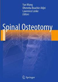 Cover image for Spinal Osteotomy