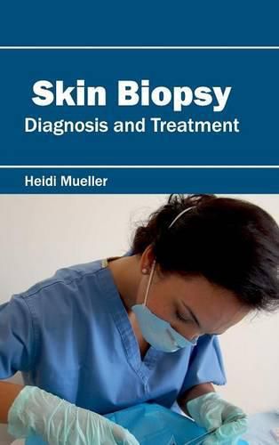 Cover image for Skin Biopsy: Diagnosis and Treatment