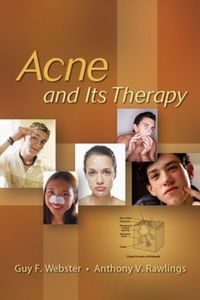 Cover image for Acne and Its Therapy