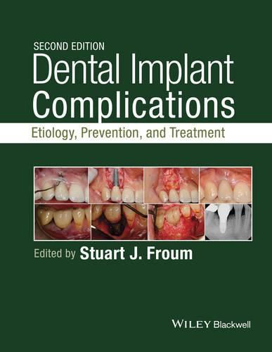 Cover image for Dental Implant Complications - Etiology, , and Treatment, Second Edition