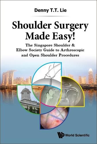 Cover image for Shoulder Surgery Made Easy!: The Singapore Shoulder & Elbow Society Guide To Arthroscopic And Open Shoulder Procedures