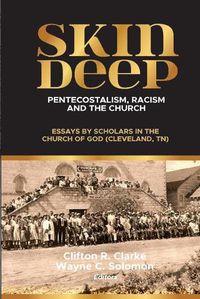 Cover image for Skin Deep: Pentecostalism, Racism and the Church: