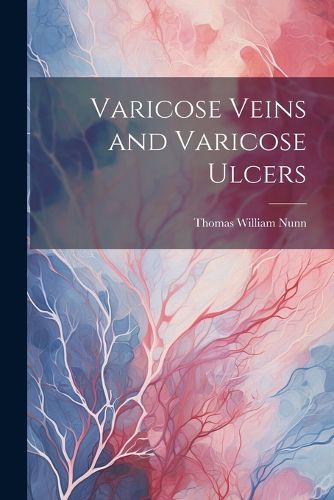 Cover image for Varicose Veins and Varicose Ulcers