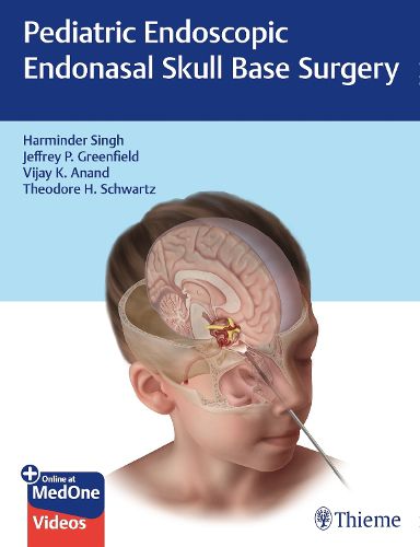 Cover image for Pediatric Endoscopic Endonasal Skull Base Surgery