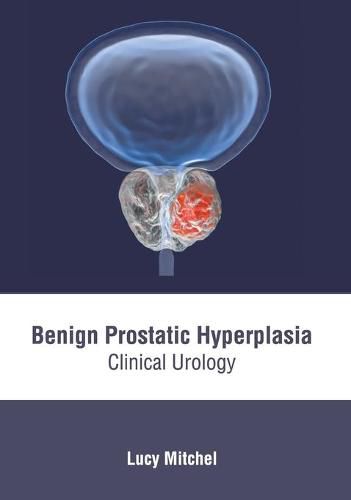 Cover image for Benign Prostatic Hyperplasia: Clinical Urology