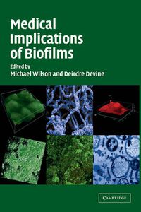 Cover image for Medical Implications of Biofilms