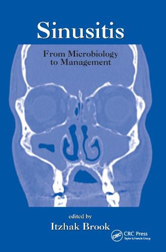 Cover image for Sinusitis: From Microbiology To Management