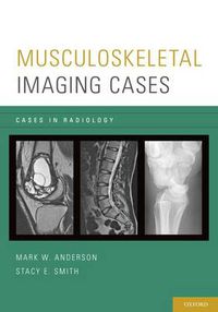 Cover image for Musculoskeletal Imaging Cases