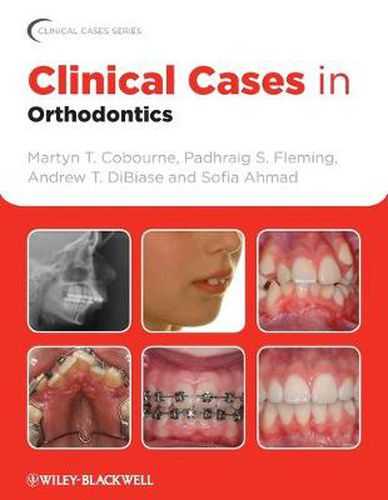 Cover image for Clinical Cases in Orthodontics