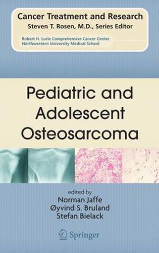 Cover image for Pediatric and Adolescent Osteosarcoma