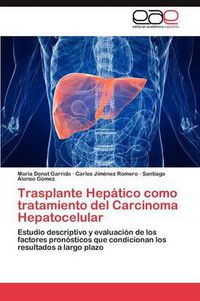 Cover image for Trasplante Hepatico como tratamiento del Carcinoma Hepatocelular
