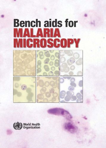 Bench AIDS for Malaria Microscopy