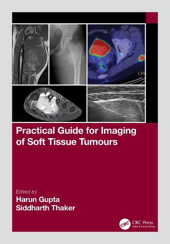 Cover image for Practical Guide for Imaging of Soft Tissue Tumours