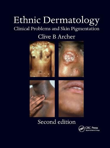 Cover image for Ethnic Dermatology: Clinical Problems and Skin Pigmentation