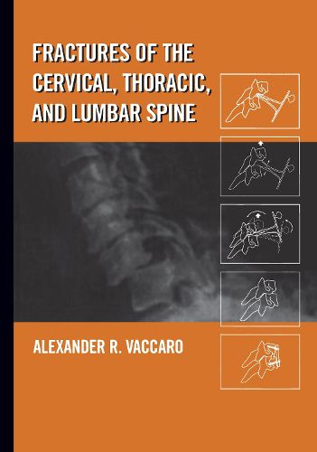 Cover image for Fractures of the Cervical, Thoracic, and Lumbar Spine