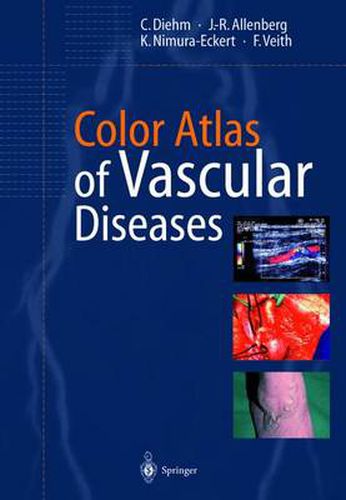 Cover image for Color Atlas of Vascular Diseases