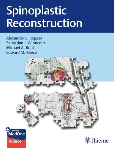 Cover image for Spinoplastic Reconstruction