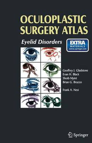 Oculoplastic Surgery Atlas: Eyelid Disorders