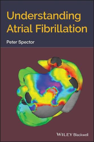 Cover image for Understanding Atrial Fibrillation