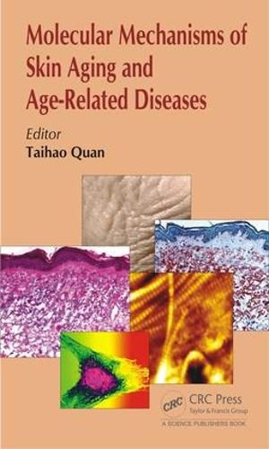 Cover image for Molecular Mechanisms of Skin Aging and Age-Related Diseases