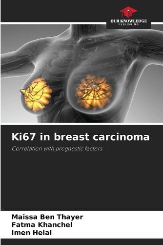 Cover image for Ki67 in breast carcinoma