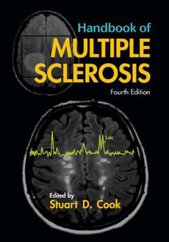 Cover image for Handbook of Multiple Sclerosis
