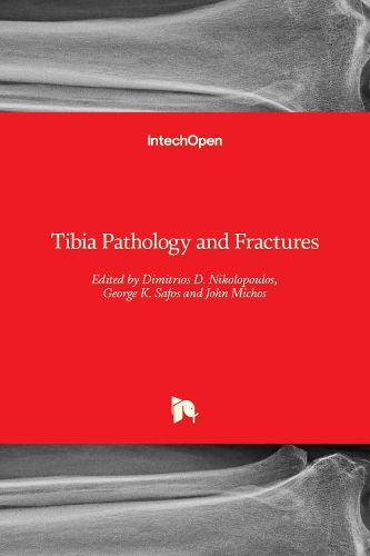 Cover image for Tibia Pathology and Fractures