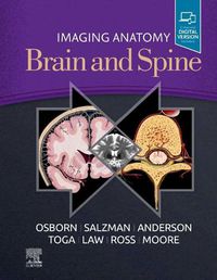 Cover image for Imaging Anatomy Brain and Spine