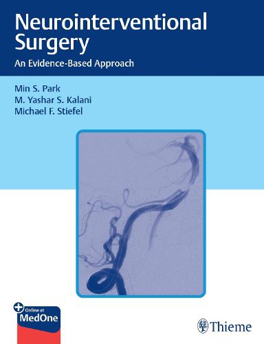 Cover image for Neurointerventional Surgery: An Evidence-Based Approach